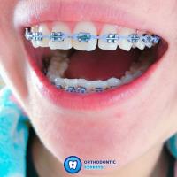 Orthodontic Experts image 3